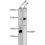 Western Blot - Anti-BLBP Antibody (A80835) - Antibodies.com