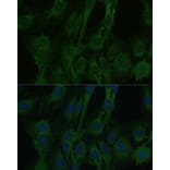 Immunofluorescence - Anti-BLBP Antibody (A80835) - Antibodies.com