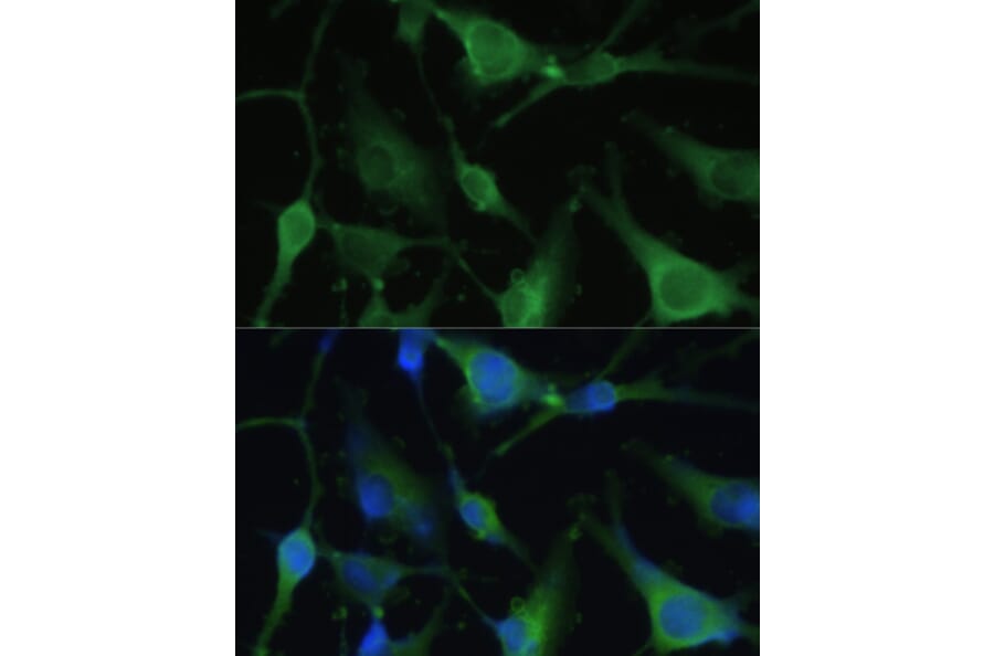 Immunofluorescence - Anti-BLBP Antibody (A80835) - Antibodies.com