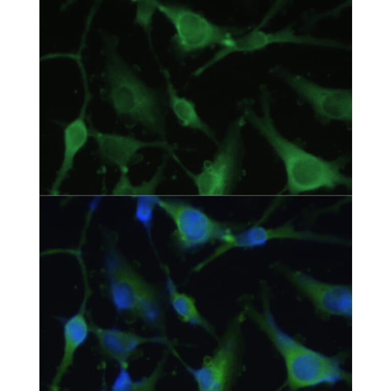 Immunofluorescence - Anti-BLBP Antibody (A80835) - Antibodies.com