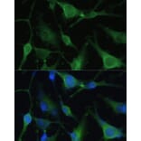 Immunofluorescence - Anti-BLBP Antibody (A80835) - Antibodies.com