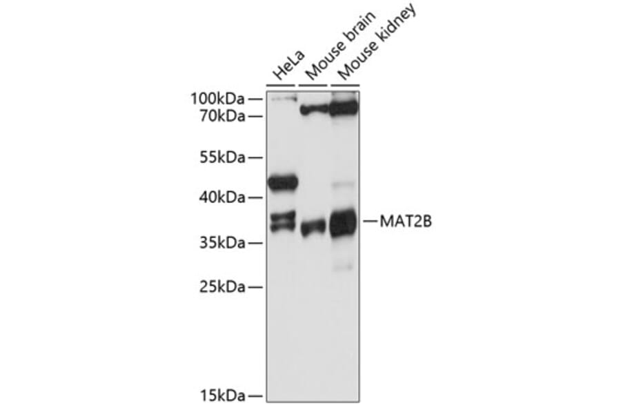 Western Blot - Anti-MAT2B/TGR Antibody (A80836) - Antibodies.com