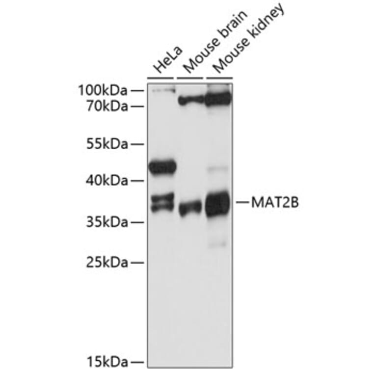 Western Blot - Anti-MAT2B/TGR Antibody (A80836) - Antibodies.com