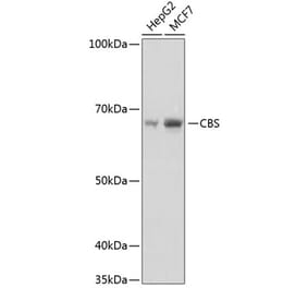 Western Blot - Anti-CBS Antibody [ARC0643] (A80837) - Antibodies.com