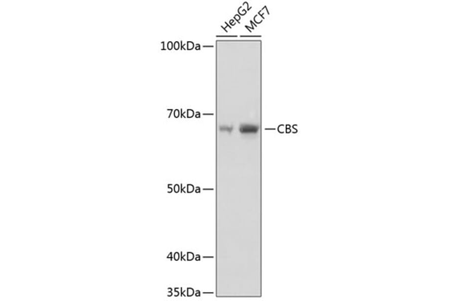 Western Blot - Anti-CBS Antibody [ARC0643] (A80837) - Antibodies.com