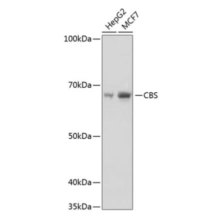 Western Blot - Anti-CBS Antibody [ARC0643] (A80837) - Antibodies.com