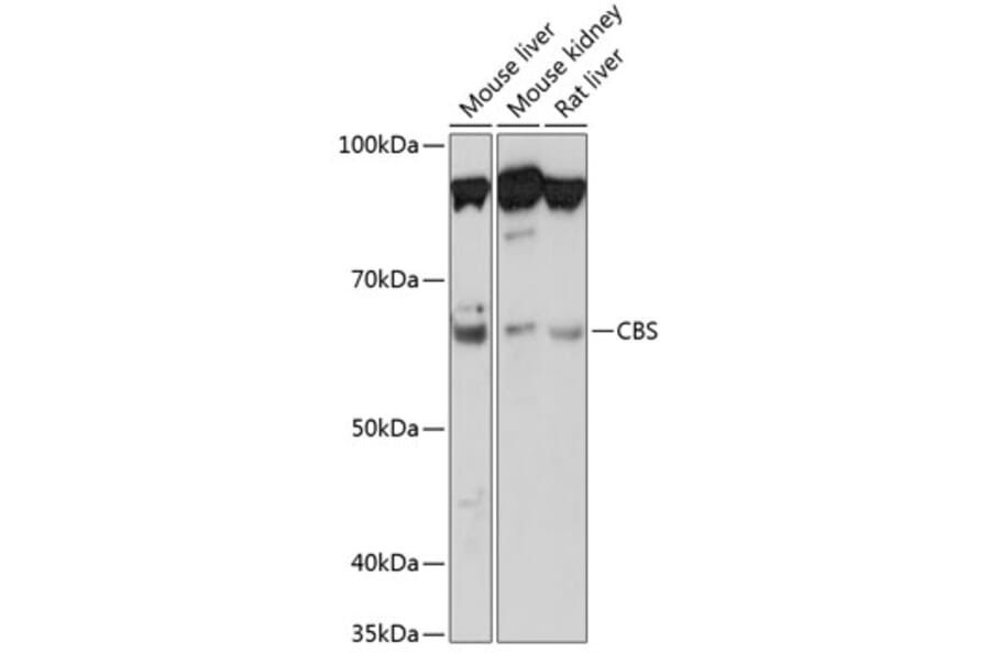 Western Blot - Anti-CBS Antibody [ARC0643] (A80837) - Antibodies.com