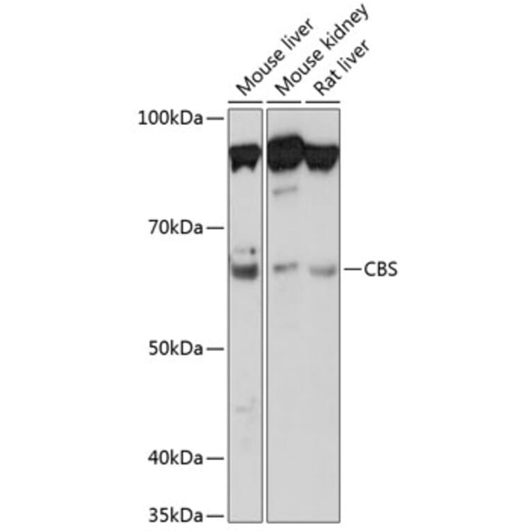 Western Blot - Anti-CBS Antibody [ARC0643] (A80837) - Antibodies.com