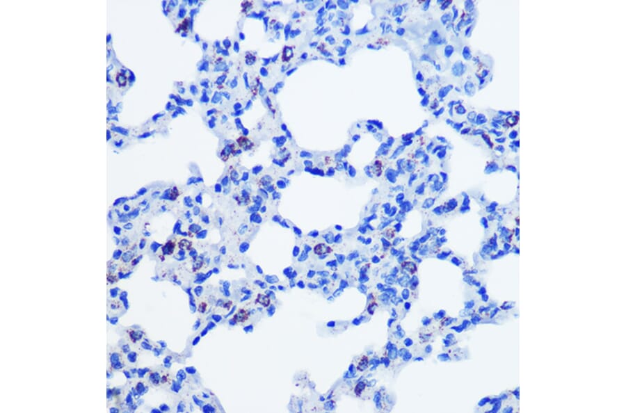 Immunohistochemistry - Anti-CBS Antibody [ARC0643] (A80837) - Antibodies.com