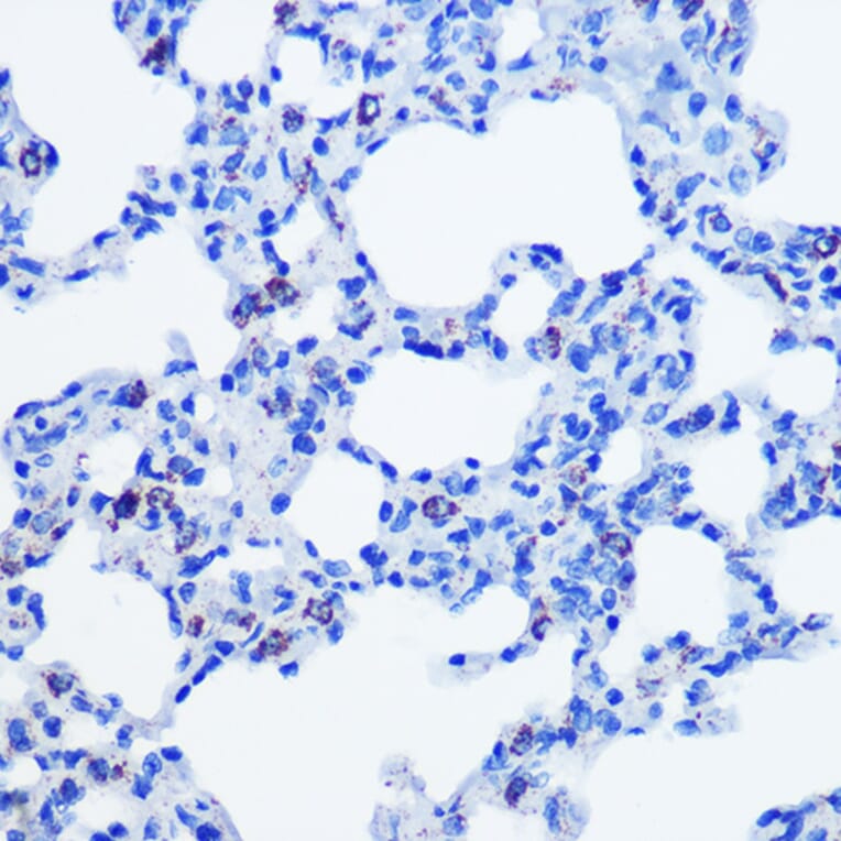 Immunohistochemistry - Anti-CBS Antibody [ARC0643] (A80837) - Antibodies.com