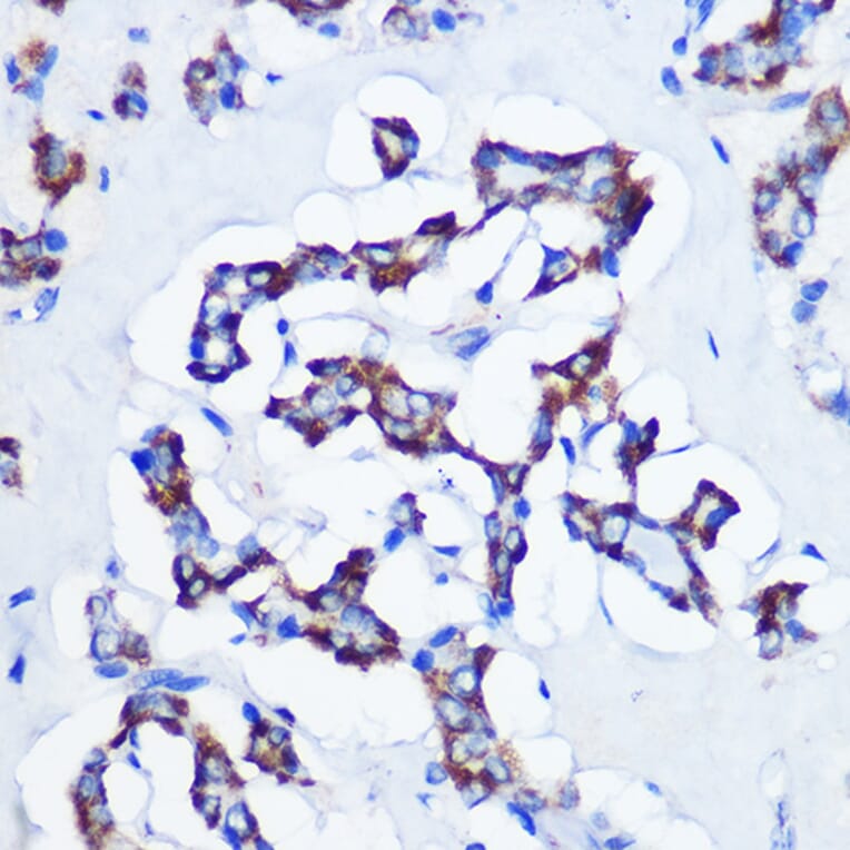 Immunohistochemistry - Anti-CBS Antibody [ARC0643] (A80837) - Antibodies.com