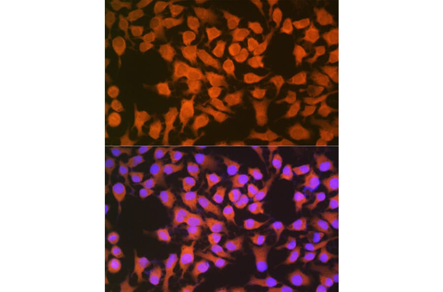 Immunofluorescence - Anti-CBS Antibody [ARC0643] (A80837) - Antibodies.com