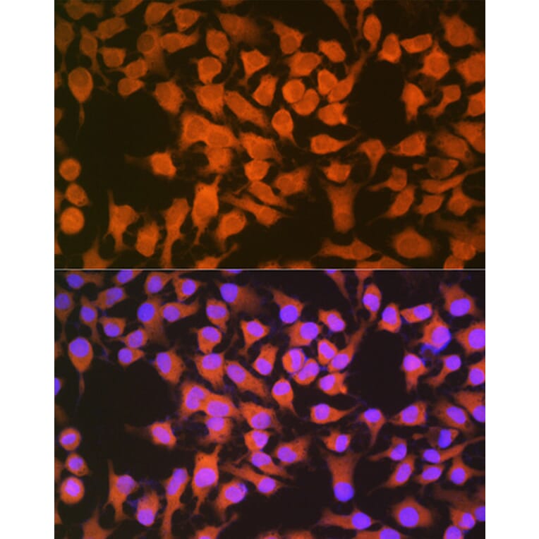 Immunofluorescence - Anti-CBS Antibody [ARC0643] (A80837) - Antibodies.com