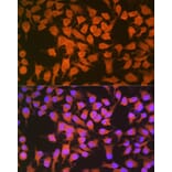 Immunofluorescence - Anti-CBS Antibody [ARC0643] (A80837) - Antibodies.com