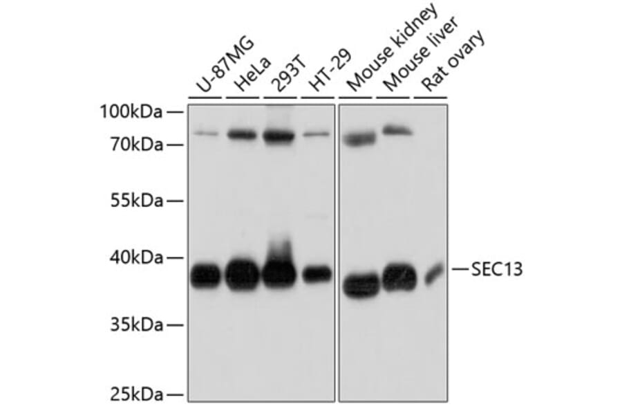 Western Blot - Anti-SEC13L1 Antibody (A80838) - Antibodies.com