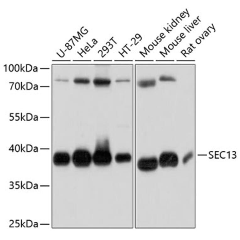 Western Blot - Anti-SEC13L1 Antibody (A80838) - Antibodies.com