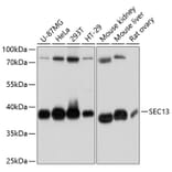 Western Blot - Anti-SEC13L1 Antibody (A80838) - Antibodies.com