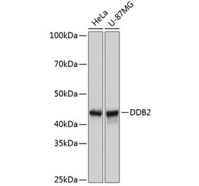 Western Blot - Anti-DDB2 Antibody [ARC0644] (A80839) - Antibodies.com