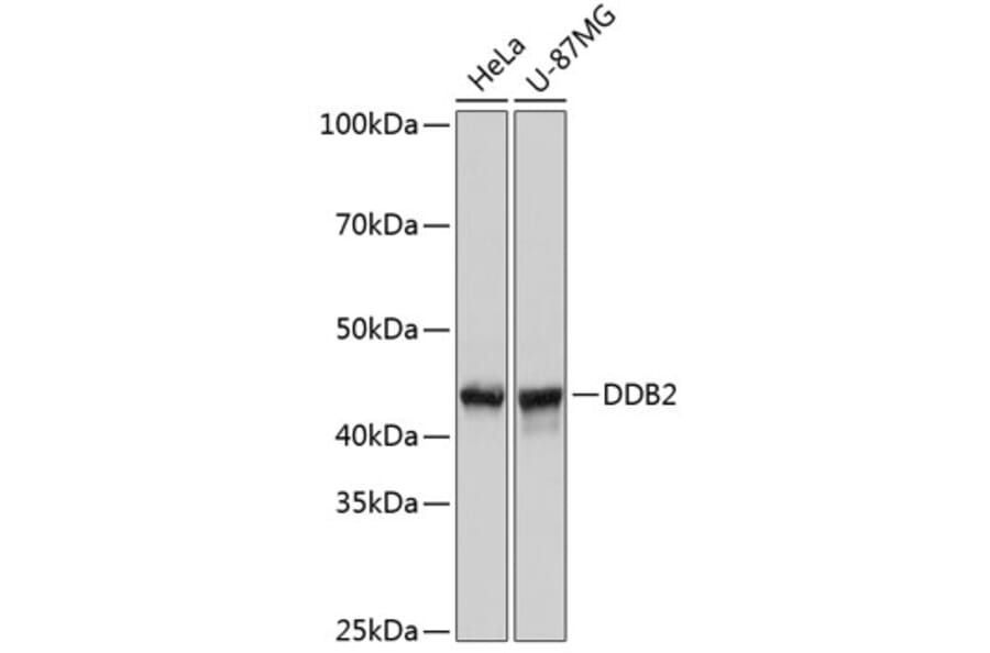 Western Blot - Anti-DDB2 Antibody [ARC0644] (A80839) - Antibodies.com