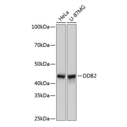 Western Blot - Anti-DDB2 Antibody [ARC0644] (A80839) - Antibodies.com