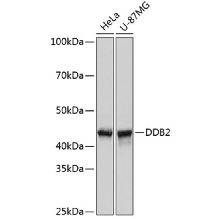 Western Blot - Anti-DDB2 Antibody [ARC0644] (A80839) - Antibodies.com