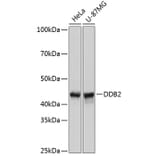 Western Blot - Anti-DDB2 Antibody [ARC0644] (A80839) - Antibodies.com