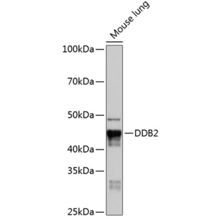 Western Blot - Anti-DDB2 Antibody [ARC0644] (A80839) - Antibodies.com