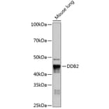 Western Blot - Anti-DDB2 Antibody [ARC0644] (A80839) - Antibodies.com
