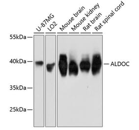 Western Blot - Anti-Aldolase C Antibody (A80840) - Antibodies.com