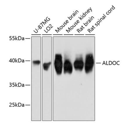 Western Blot - Anti-Aldolase C Antibody (A80840) - Antibodies.com
