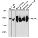 Western Blot - Anti-Aldolase C Antibody (A80840) - Antibodies.com