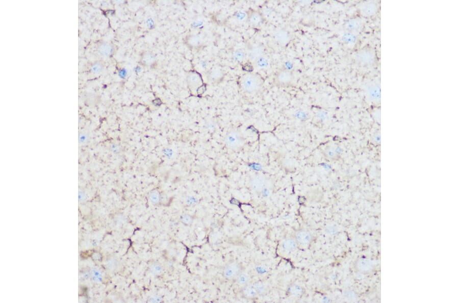 Immunohistochemistry - Anti-Aldolase C Antibody (A80840) - Antibodies.com