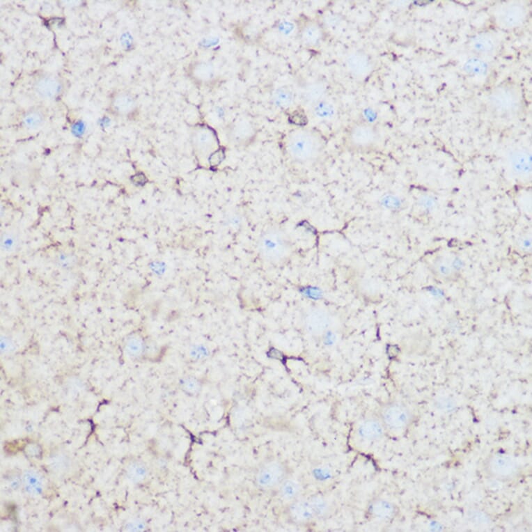 Immunohistochemistry - Anti-Aldolase C Antibody (A80840) - Antibodies.com
