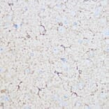 Immunohistochemistry - Anti-Aldolase C Antibody (A80840) - Antibodies.com