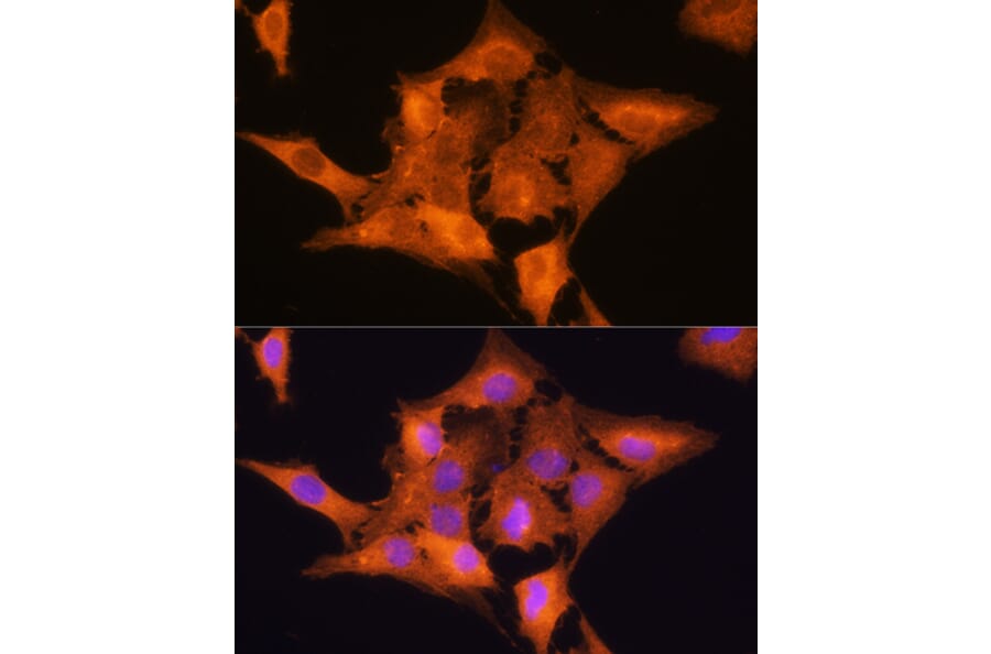 Immunofluorescence - Anti-Aldolase C Antibody (A80840) - Antibodies.com
