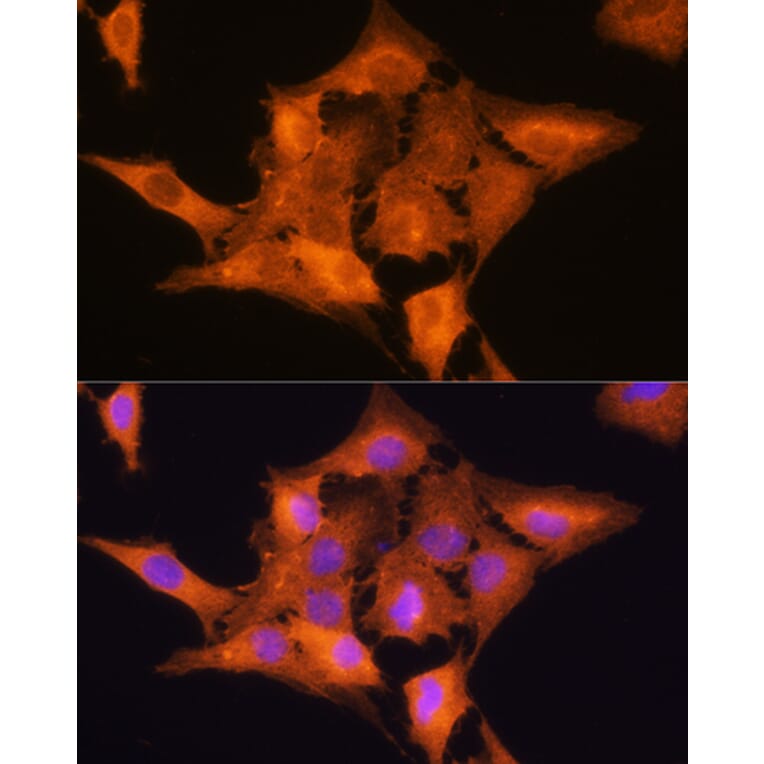 Immunofluorescence - Anti-Aldolase C Antibody (A80840) - Antibodies.com