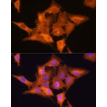 Immunofluorescence - Anti-Aldolase C Antibody (A80840) - Antibodies.com