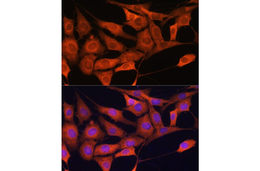 Immunofluorescence - Anti-Aldolase C Antibody (A80840) - Antibodies.com