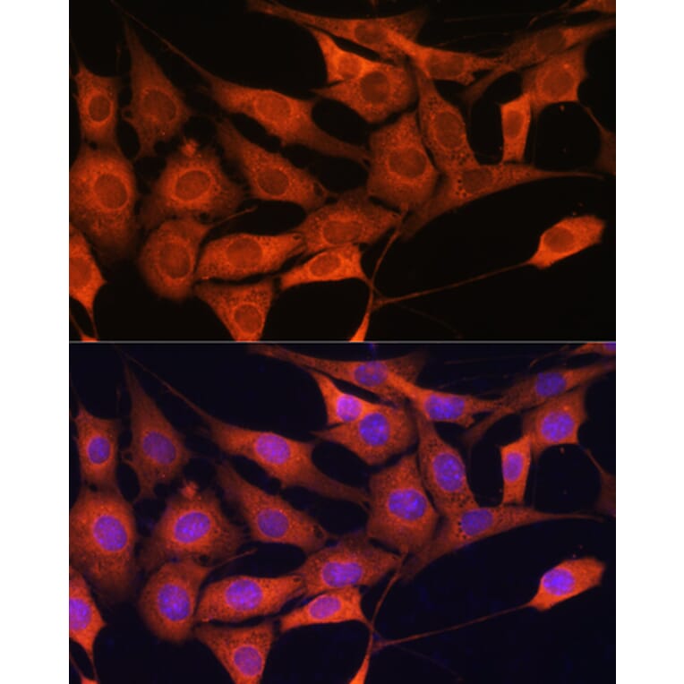 Immunofluorescence - Anti-Aldolase C Antibody (A80840) - Antibodies.com