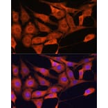 Immunofluorescence - Anti-Aldolase C Antibody (A80840) - Antibodies.com