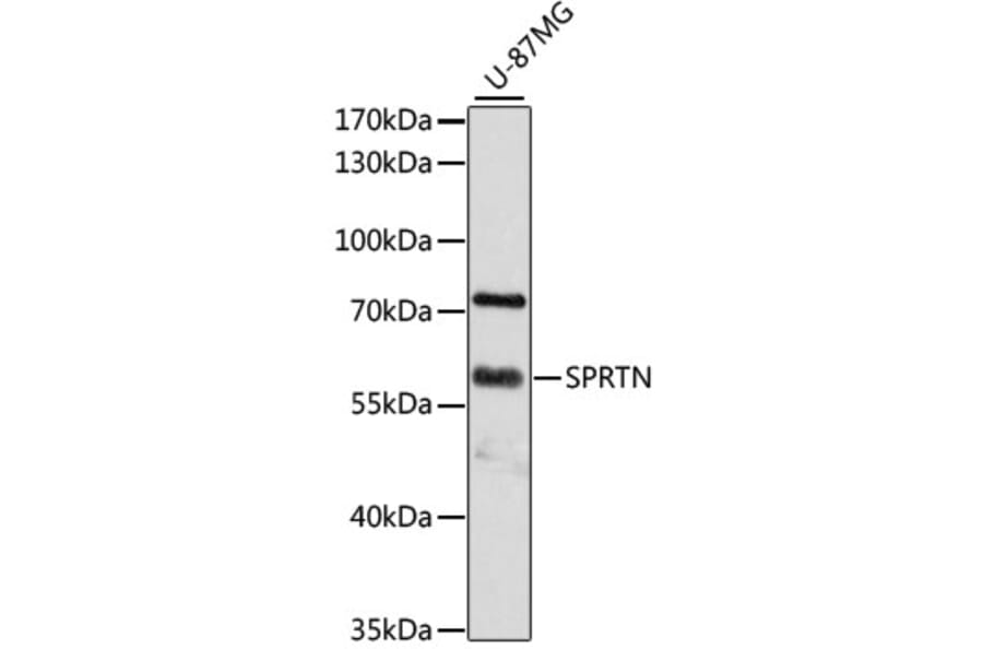 Western Blot - Anti-Spartan Antibody (A80841) - Antibodies.com