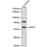 Western Blot - Anti-Spartan Antibody (A80841) - Antibodies.com