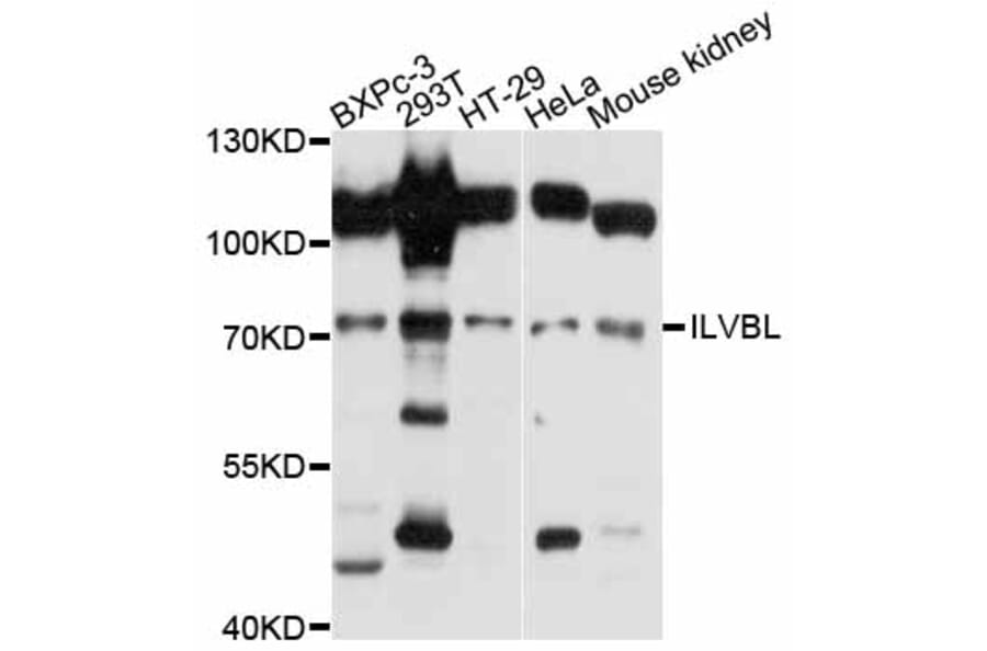 Western Blot - Anti-ILVBL Antibody (A11624) - Antibodies.com