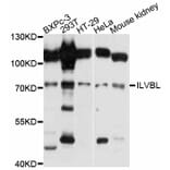 Western Blot - Anti-ILVBL Antibody (A11624) - Antibodies.com