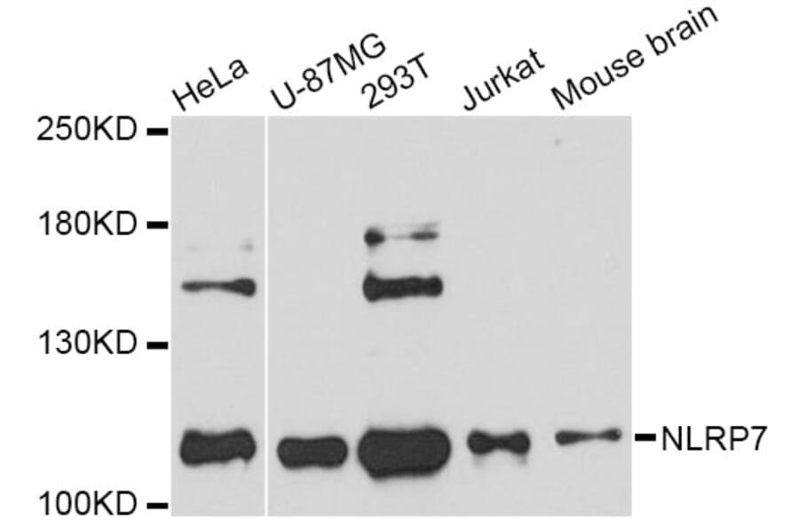 Western Blot - Anti-NLRP7 Antibody (A11627) - Antibodies.com