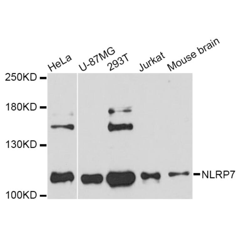Western Blot - Anti-NLRP7 Antibody (A11627) - Antibodies.com
