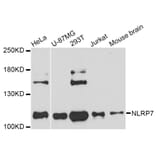 Western Blot - Anti-NLRP7 Antibody (A11627) - Antibodies.com