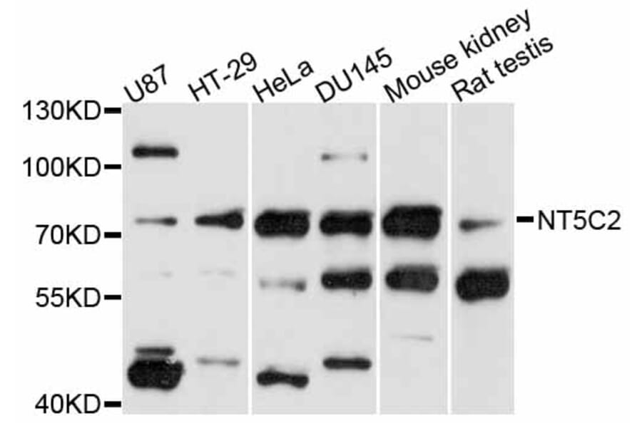 Western Blot - Anti-NT5C2 Antibody (A11628) - Antibodies.com