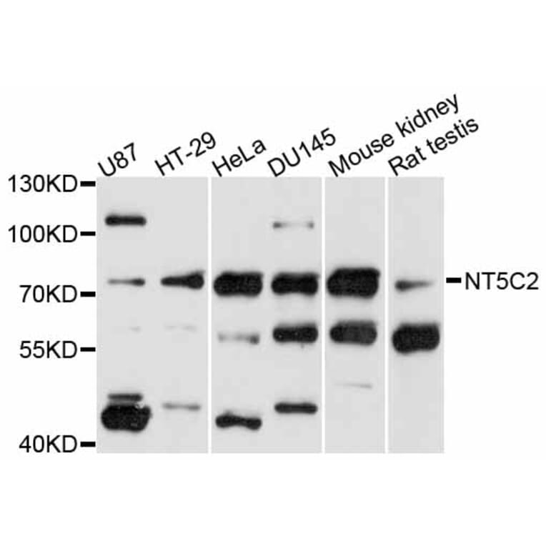 Western Blot - Anti-NT5C2 Antibody (A11628) - Antibodies.com