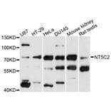 Western Blot - Anti-NT5C2 Antibody (A11628) - Antibodies.com